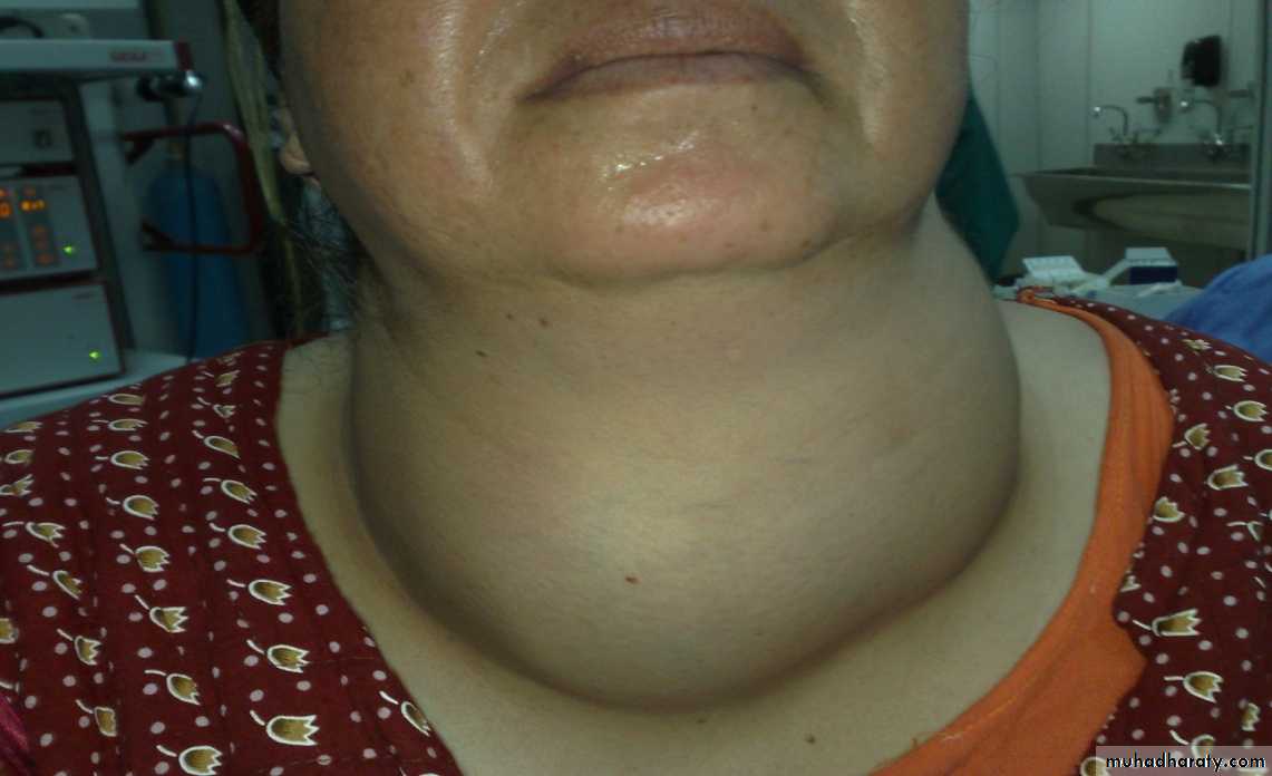 Thyroid gland