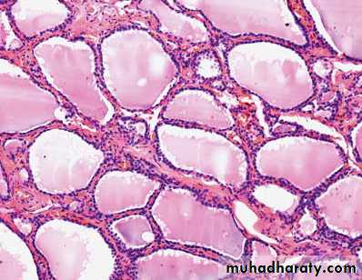 Thyroid gland