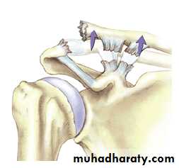 Injuries of upper limbs