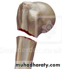 Injuries of upper limbs