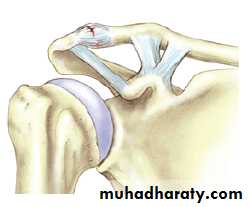 Injuries of upper limbs