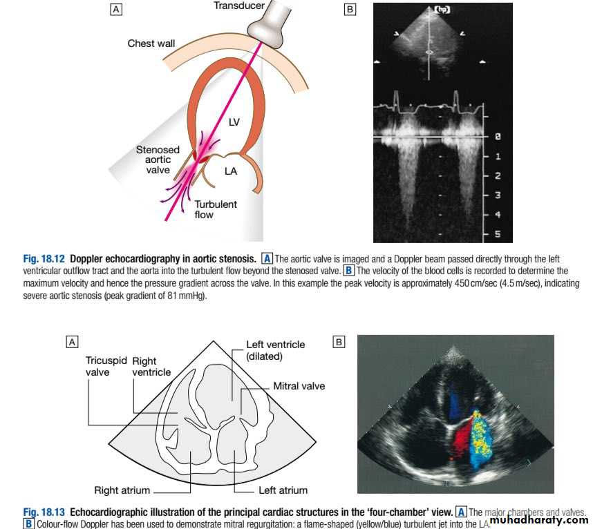 INVESTIGATION OF CARDIOVASCULAR SYSTEM