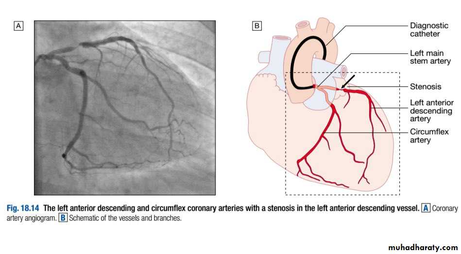 INVESTIGATION OF CARDIOVASCULAR SYSTEM