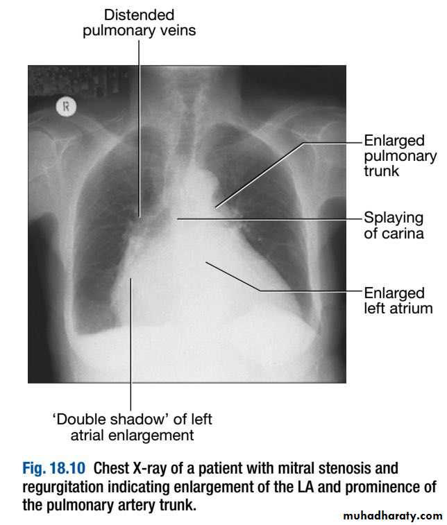 INVESTIGATION OF CARDIOVASCULAR SYSTEM
