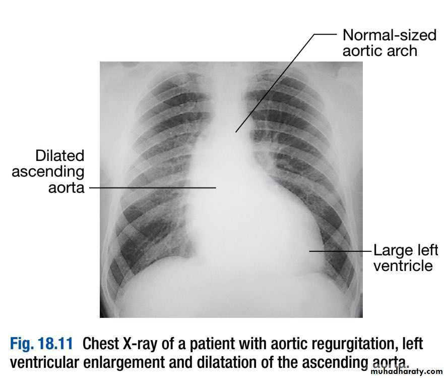 INVESTIGATION OF CARDIOVASCULAR SYSTEM