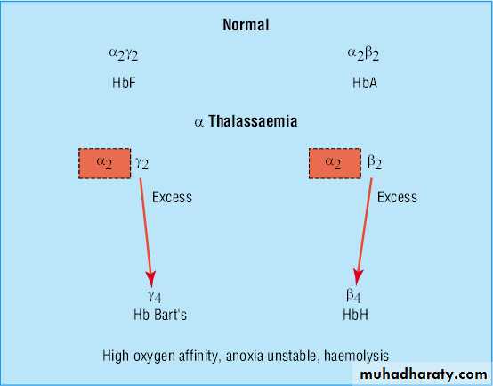 Thalassemia