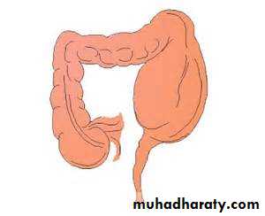 Pathology of GIT- Intestine