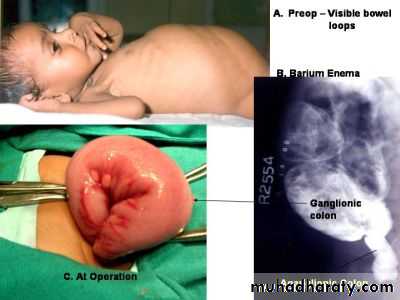 Pathology of GIT- Intestine