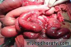 Pathology of GIT- Intestine