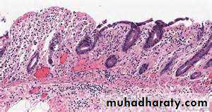 Pathology of GIT- Intestine
