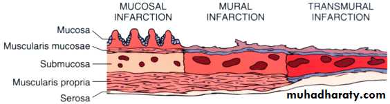 Pathology of GIT- Intestine