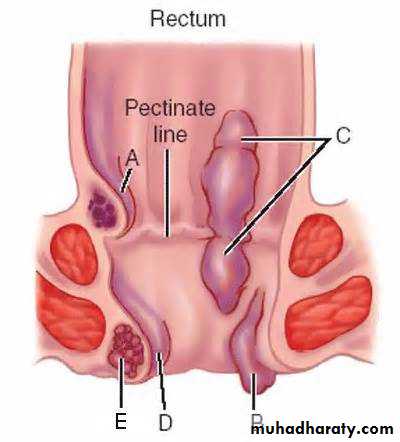Pathology of GIT- Intestine