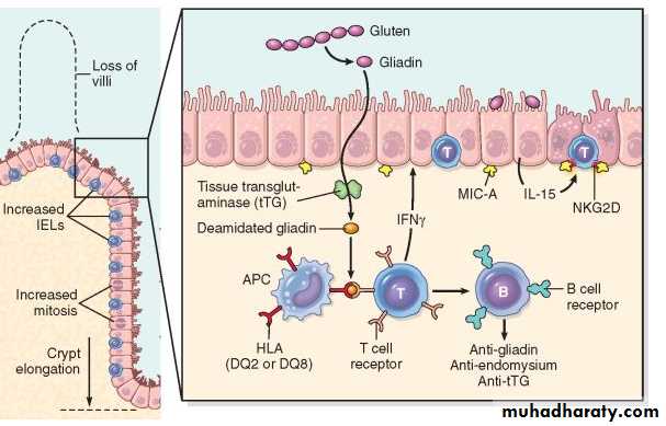 Pathology of GIT- Intestine