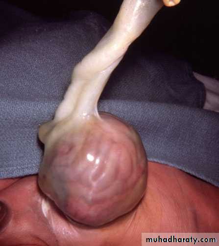 Pathology of GIT- Intestine