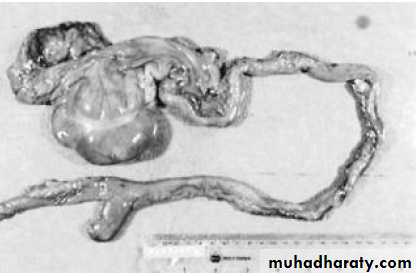 Pathology of GIT- Intestine