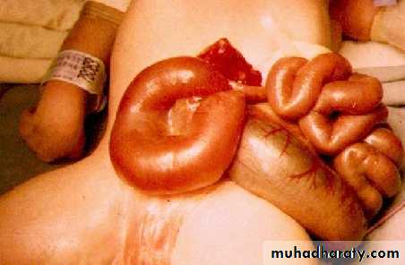 Pathology of GIT- Intestine