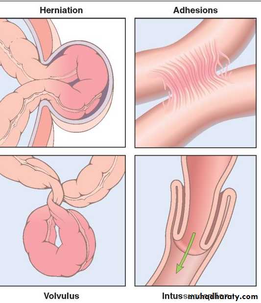 Pathology of GIT- Intestine