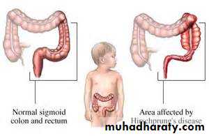 Pathology of GIT- Intestine