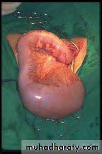 Pathology of GIT- Intestine