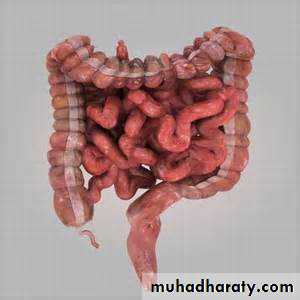 Pathology of GIT- Intestine