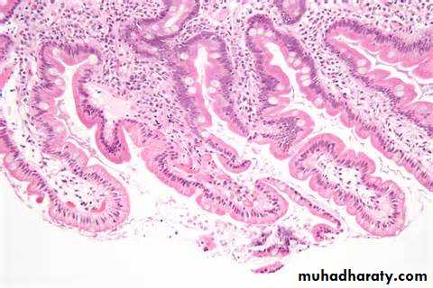 Pathology of GIT- Intestine