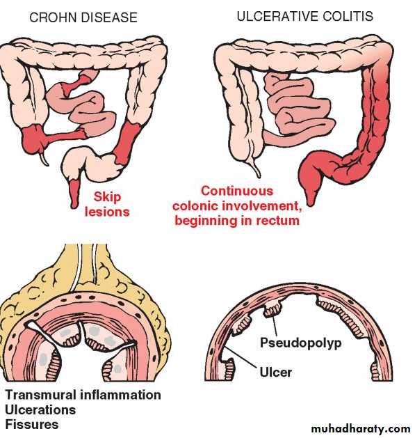 Pathology of GIT- Intestine