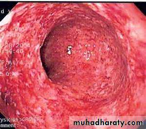 Pathology of GIT- Intestine
