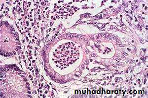 Pathology of GIT- Intestine