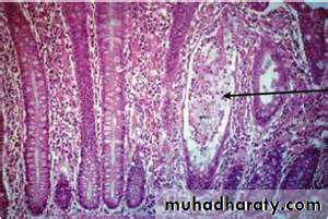 Pathology of GIT- Intestine