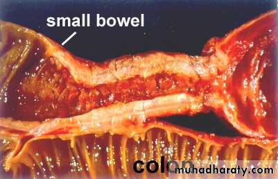 Pathology of GIT- Intestine