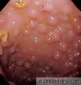 Pathology of GIT- Intestine