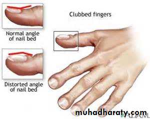 Pathology of GIT- Intestine