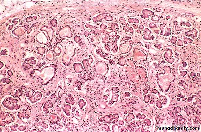 Pathology of GIT- Intestine