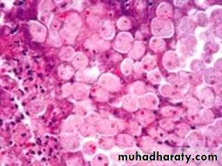 Pathology of GIT- Intestine