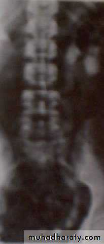 PARATHYROID NEW