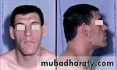 PARATHYROID NEW