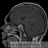 PARATHYROID NEW