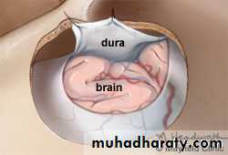 PARATHYROID NEW