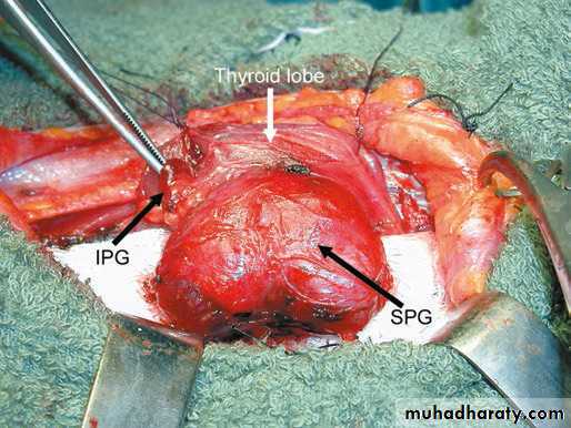 PARATHYROID NEW