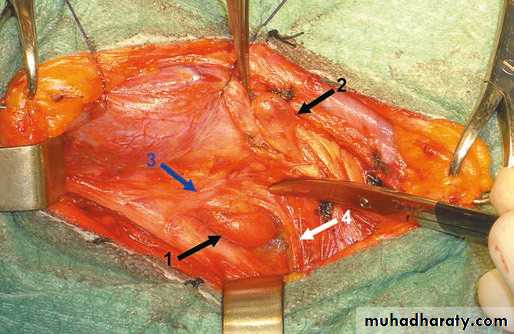PARATHYROID NEW