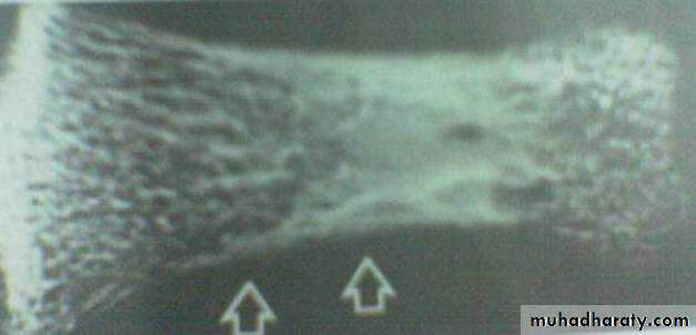 PARATHYROID NEW