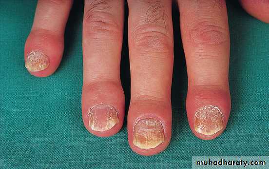 Crystals associated diseases 3