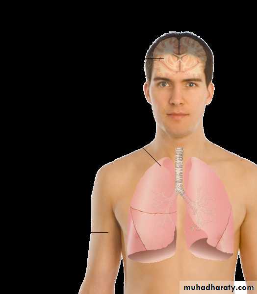 Crystals associated diseases 3