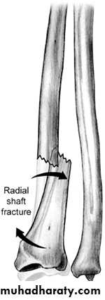 Fractures of the radius and ulna