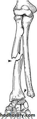 Fractures of the radius and ulna