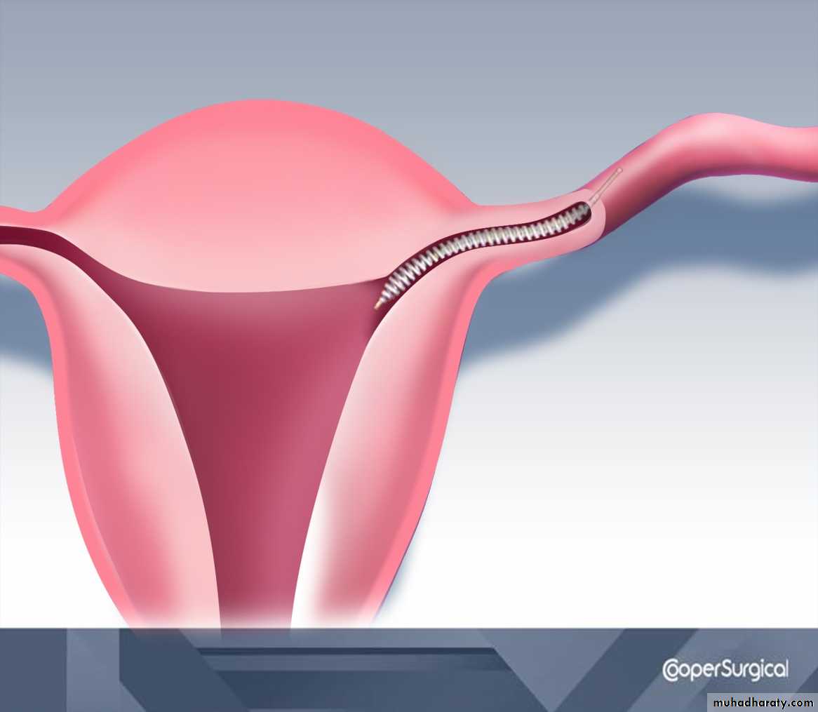 sterilization