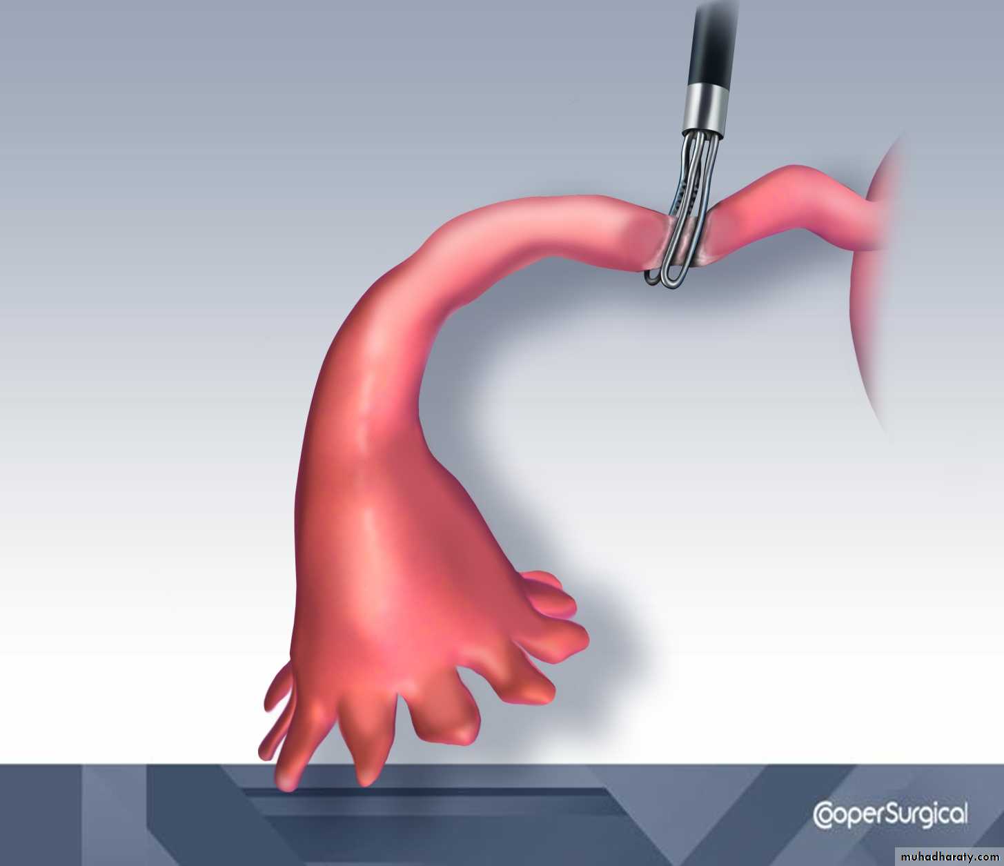 sterilization