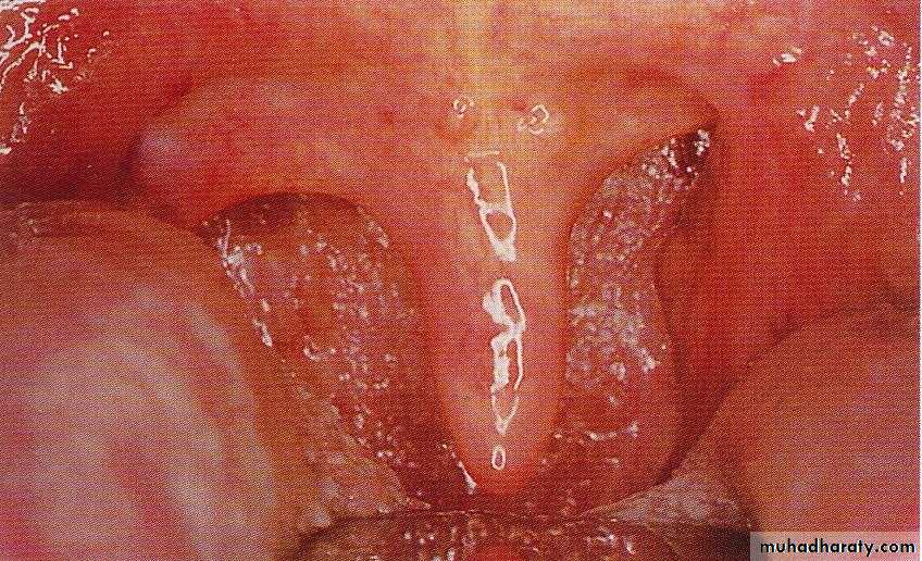 pharynx
