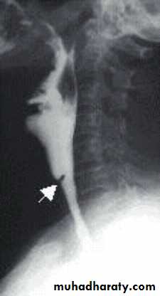 pharynx