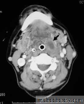 pharynx